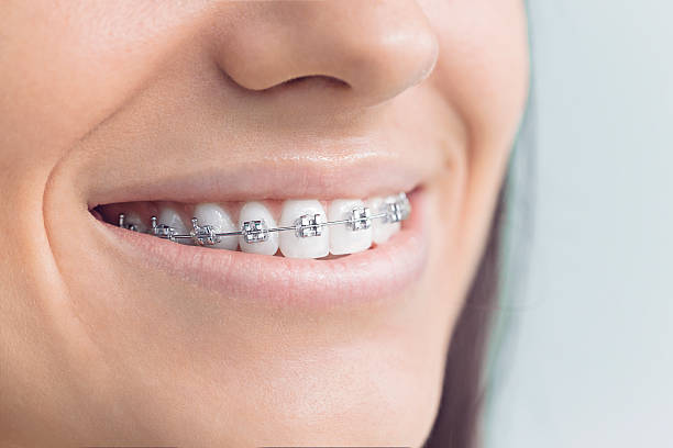Best Sedation Dentistry  in Diand, MO